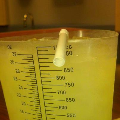 What you drink before a cat scan.  